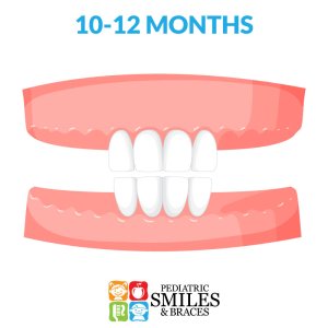 Illustration of 10-12 month old baby teeth