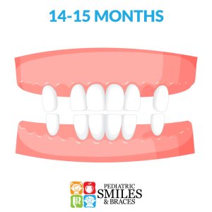Illustration of 14-15 month old baby teeth
