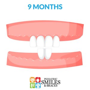 Illustration of 9 month old baby teeth