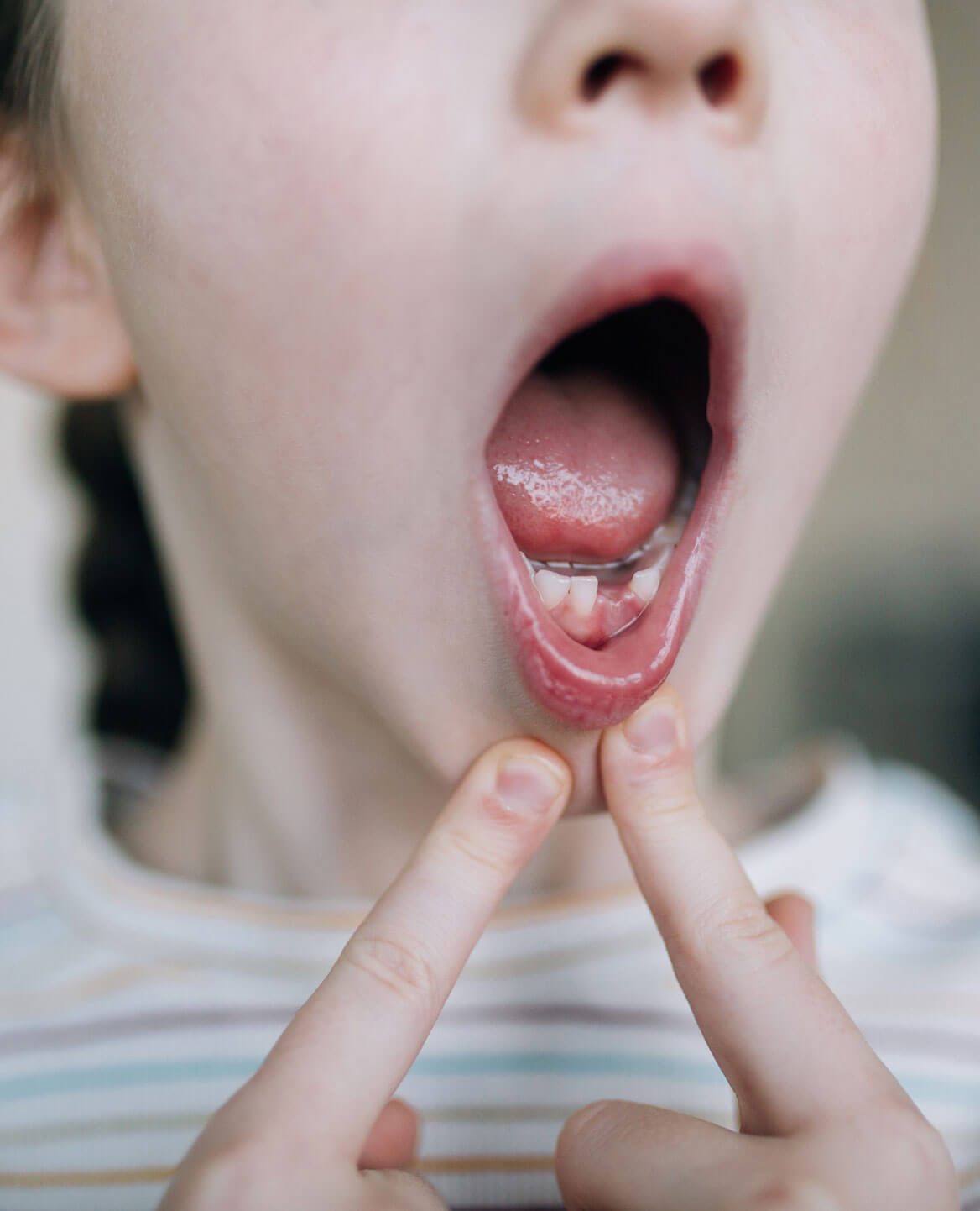 Emergency dental services at Pediatric Smiles and Braces of Orem, UT.