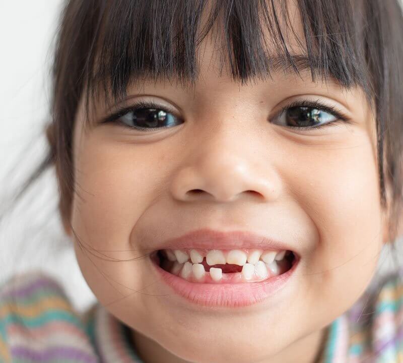The key to understanding baby teeth and how to care for them.